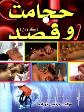 دانلود رایگان کتاب حجامت وفصد رگ زدن با فرمت pdf 1 دانلود رایگان کتاب حجامت وفصد رگ زدن با فرمت pdf